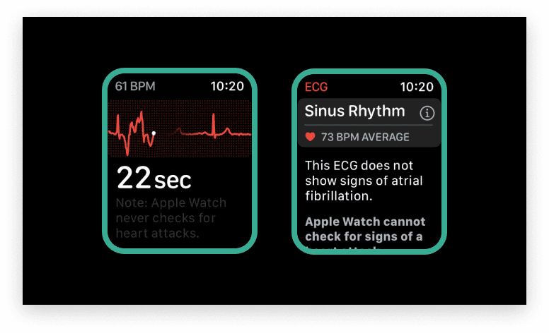 Apple Watch electrocardiogram app